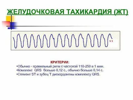 Частота 110