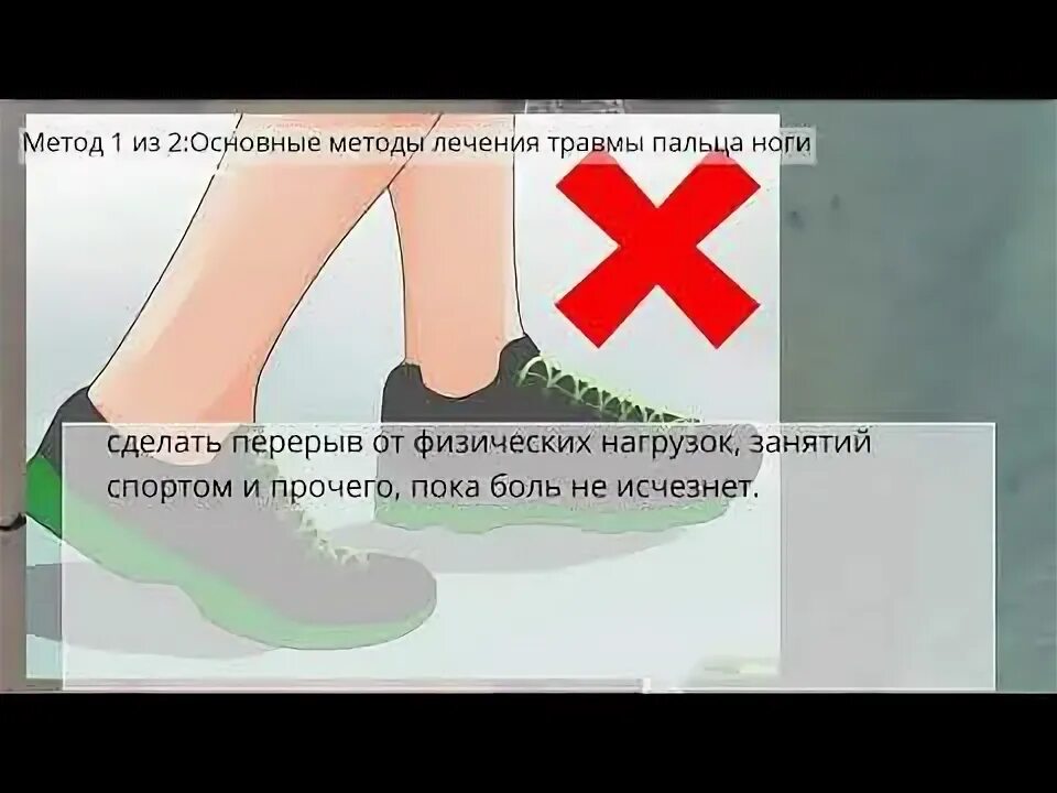 Ушиб пальца спустя 2 недели - Вопрос ортопеду-травматологу - 03 Онлайн
