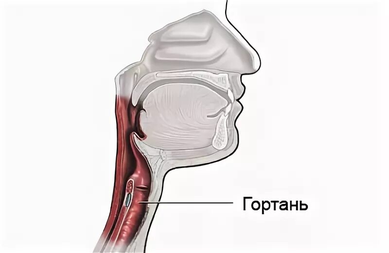 Блокада носа. Носоглотка надгортанник. Хондроперихондрит гортани фото. Анатомия горла человека.