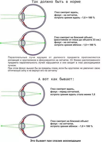 Норма зрения в год. Фокус зрения. Зрение какое должно быть в норме. Нормальное зрение у ребенка 7 лет. Норма глазного зрения.