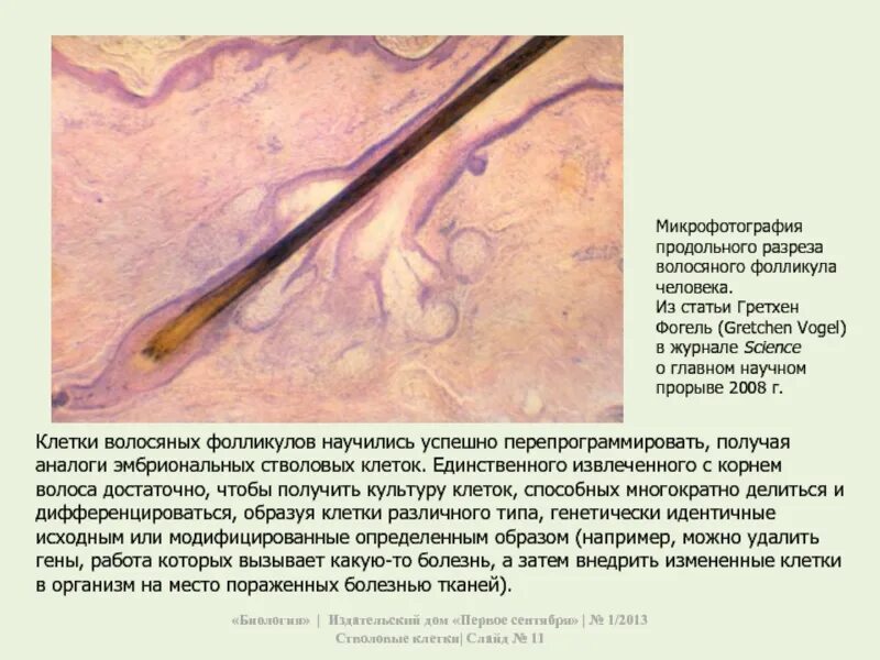 Клетки волосяного фолликула. Стволовые клетки волосяного фолликула. Волосяной фолликул микрофотография. Строение волоса стволовые клетки.