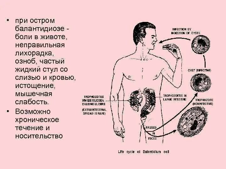 Слизь и боли внизу живота