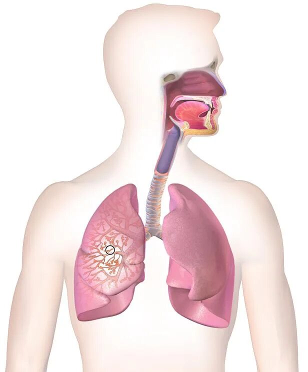 Бронхит история. Бронхиальная астма. Дыхательная система и астма. Болезни органов дыхания бронхиальная астма.