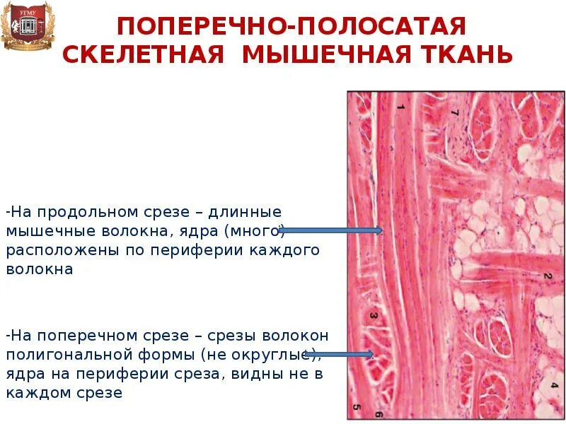 Волокна поперечно полосатой мышечной ткани ядра. Поперечно-полосатая мышечная ткань языка гистология. Поперечно полосатая мышечная ткань препарат. Поперечно полосатое мышечное волокно гистология. Препарат - поперечно-полосатая Скелетная мышечная ткань; срез языка..