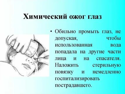 Ожоги глаз тест нмо