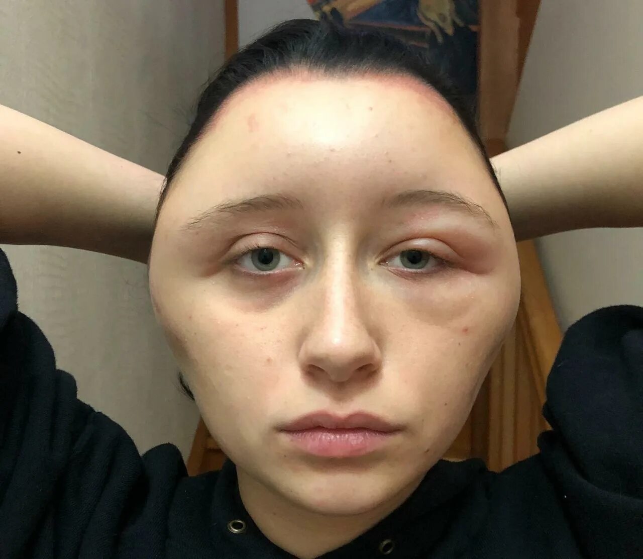 Лоб ли
