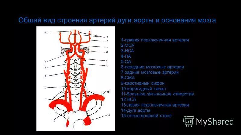 7 артерии. Конечные ветви базилярной артерии. внутренняя сонная и подключичная артерии схема. ветви аорты и головного мозга. дуга аорты правая подключичная артерия.