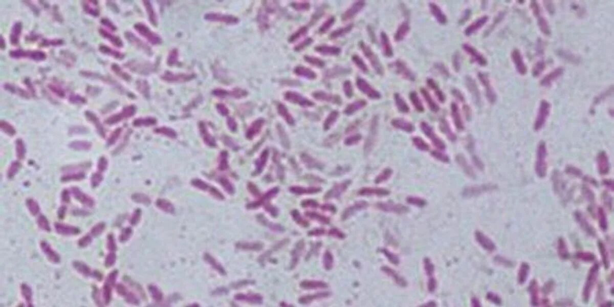 Pseudomonas Fluorescens препараты. Pseudomonas Fluorescens под микроскопом оптическим. Pseudomonas Fluorescens Results. Pseudomonas Fluorescens in Agriculture.