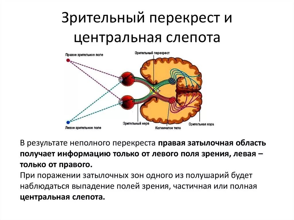 Перекрест зрительных путей физиология. Где происходит Перекрест зрительных нервов. Зрительный нерв тракт и Перекрест. Зрительный Перекрест образован волокнами.