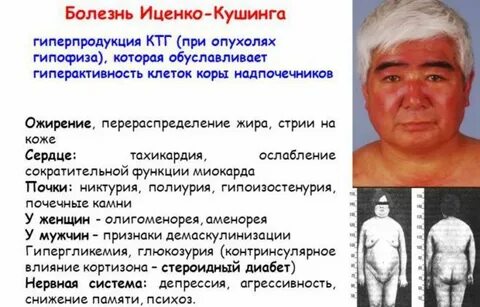 Рак надпочечников симптомы признаки у женщин