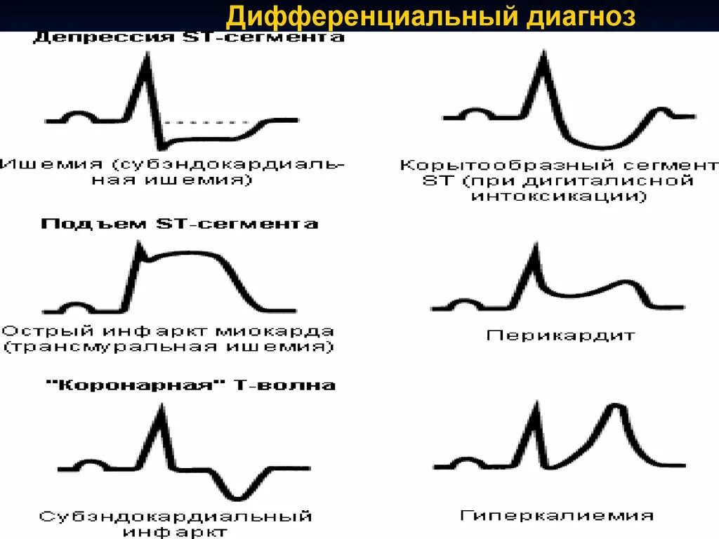 Постановка экг алгоритм. Техника постановки экг. снятие экг алгоритм. схема снятия экг. схема постановки экг.