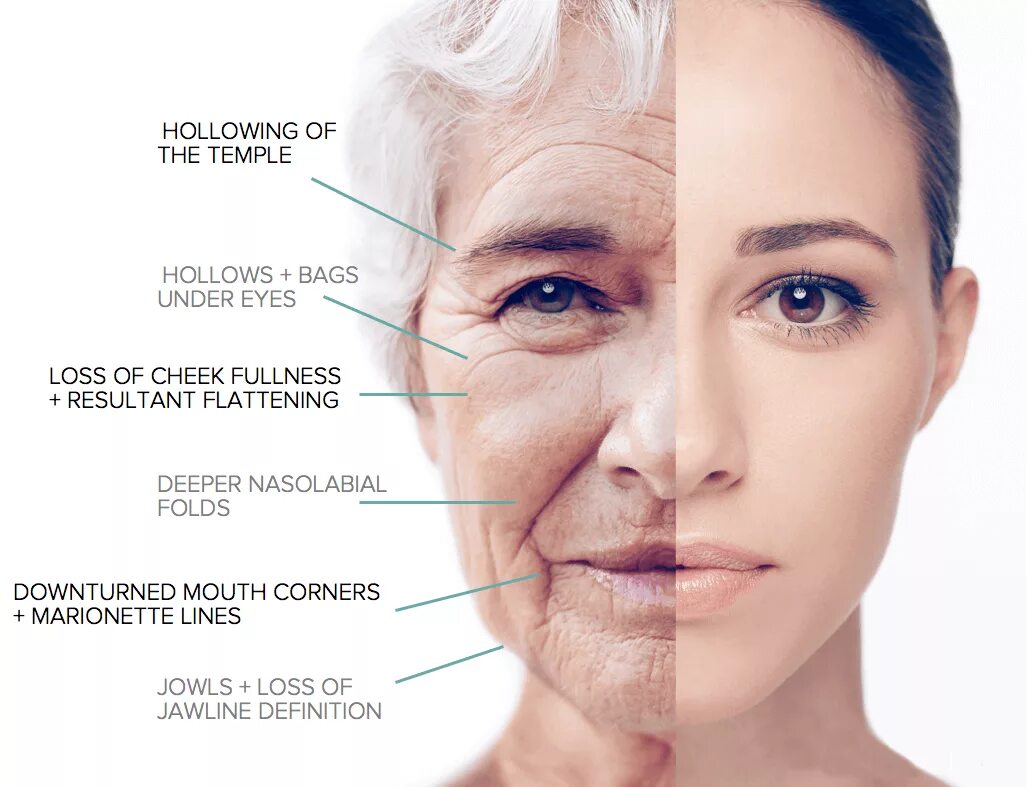 Лица по возрасту. Возрастные изменения кожи лица. Анатомия старения лица. Возрастные изменения кожи у женщин. Кожа старение анатомия.
