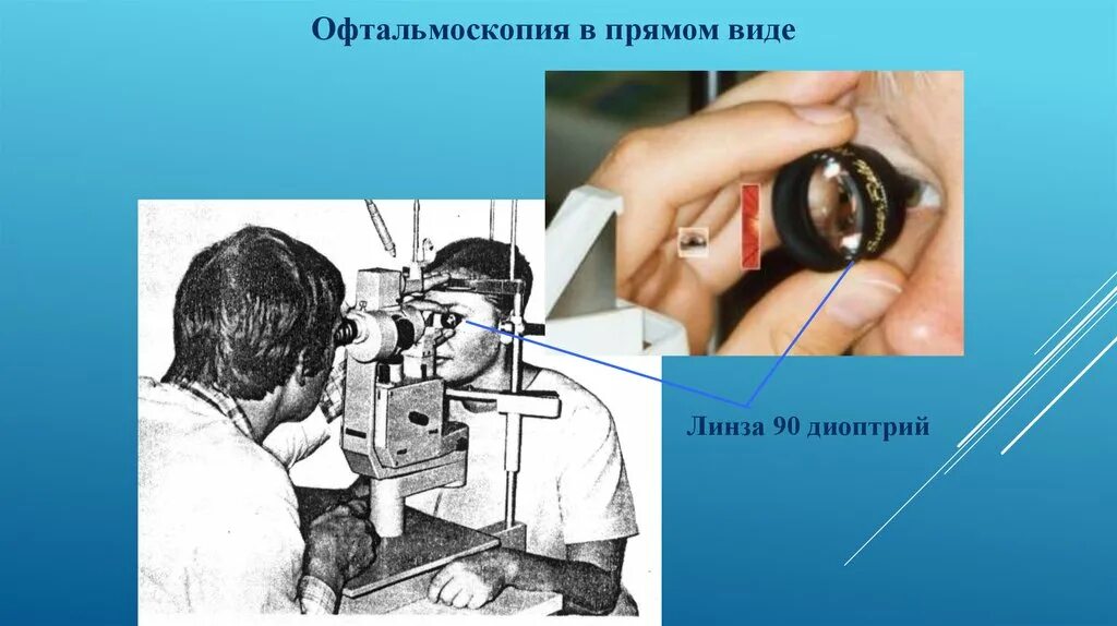 Лазерный прибор офтальмоскопия. Офтальмолог презентация. Офтальмоскопия в различных спектральных. Прямая офтальмоскопия. Офтальмоскопия линзой