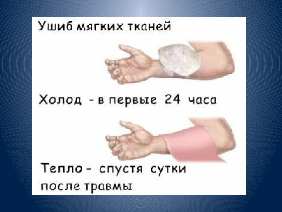 Ушиб мягких тканей первая помощь. Первая помощь при ушибах мягких тканей. ушиб мягких тканей руки.