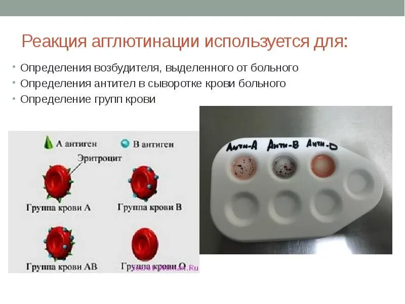 Определение реакции агглютинации. Реакция агглютинации. реакция агглютинации виды. реакция агглютинации крови. реакцию агглютинации применяют для определения.