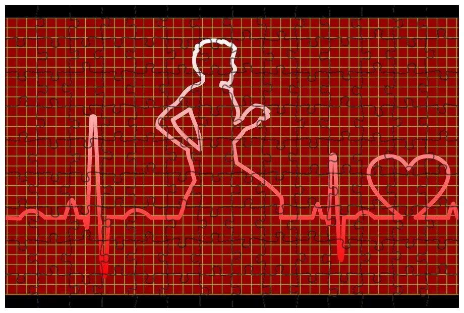Сердцебиения 27. Пульс рисунок. Пульс кардиограмма. ЭКГ сердца. Сердечный ритм здорового человека.