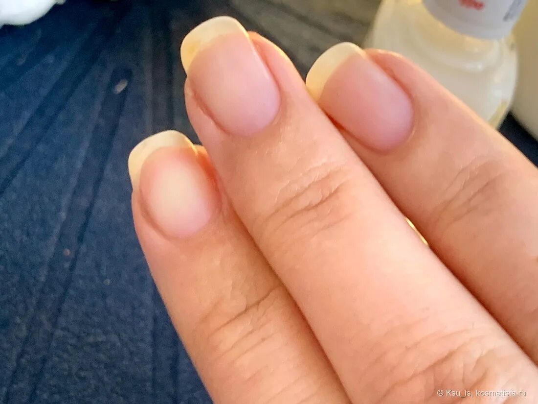 Лечебный лак. Формальдегид в лаке для ногтей для чего. Формальдегид в лаке для ногтей. Укрепляющее средство для ногтей с формальдегидом. Формальдегид 2 в лаке.