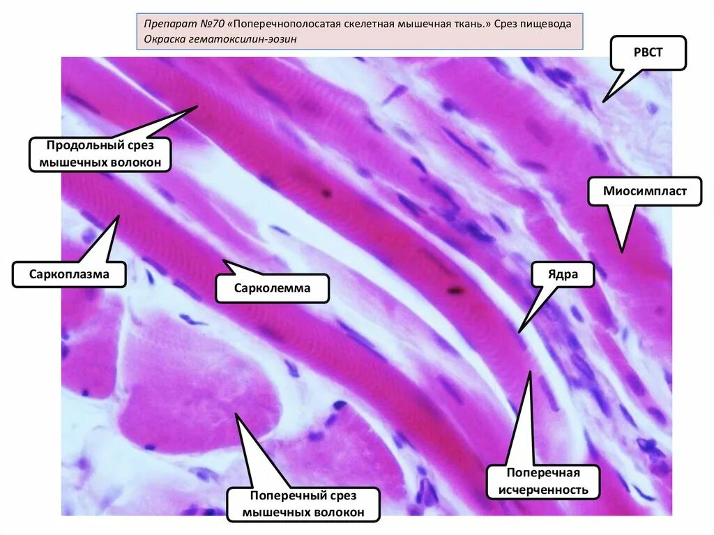 Скелетная мышечная ткань гистология препарат. Мышечное волокно Симпласт гистология. Поперечно мышечная ткань гистология. Поперечно полосатая ткань гистология. Препарат поперечно полосатая мышечная ткань