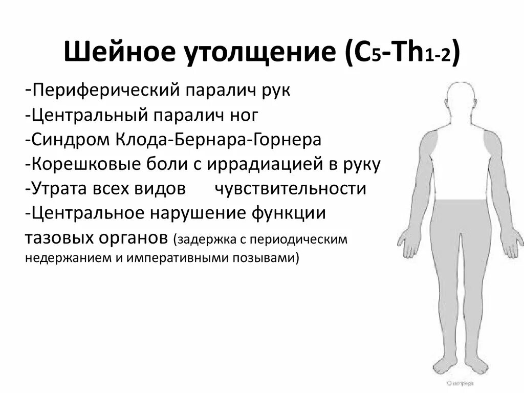 Симптомы поражения шейного утолщения спинного мозга. Синдром поражения шейного утолщения спинного мозга. Синдром поражения поясничного утолщения спинного мозга. Синдром поперечного поражения шейного утолщения спинного мозга..