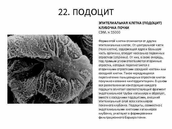 Фильтрационный барьер нефрона. Базальная мембрана подоцитов функции. Подоциты. Подоциты почки гистология. Подоциты.