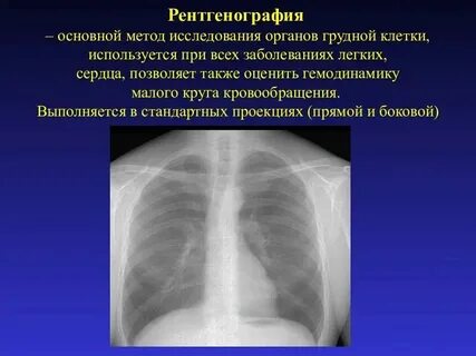 Узи рентгенологический метод