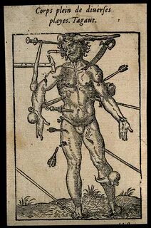 Wound man