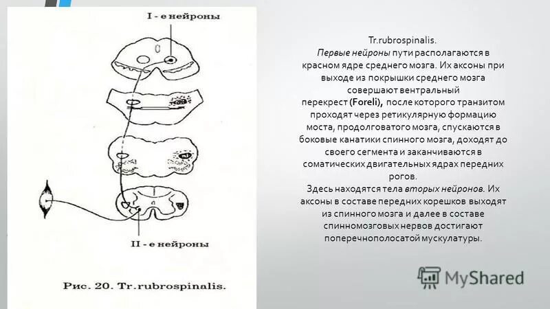 Строение среднего мозга поперечный разрез. Перекрест фореля. Вентральный перекрест покрышки. Схема поперечного разреза среднего мозга. Поперечный срез среднего мозга схема.
