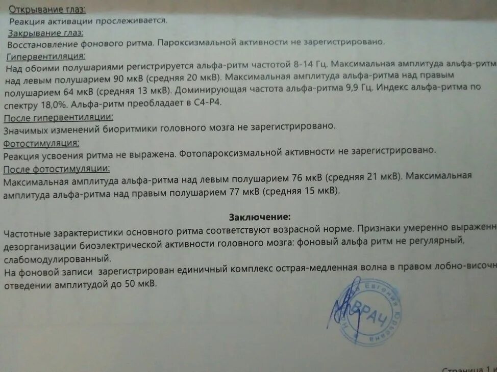 Активность ээг у ребенка что это. ЭЭГ заключение норма. ЭЭГ головного мозга заключение норма у взрослого. Заключение ЭЭГ норма у взрослого. Заключение энцефалограммы в норме у взрослого.