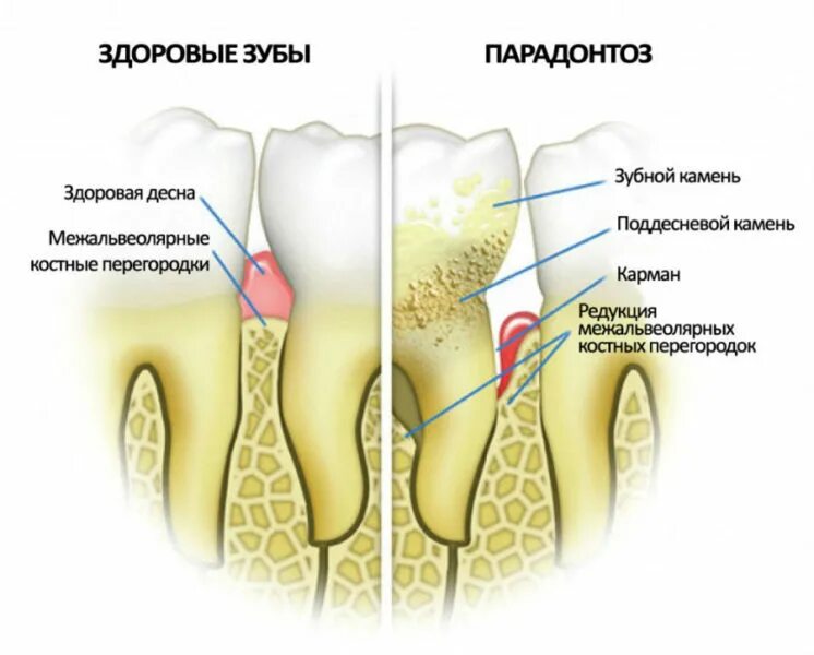 Зуб пульсирует и болит. Зуб пульсирует и болит