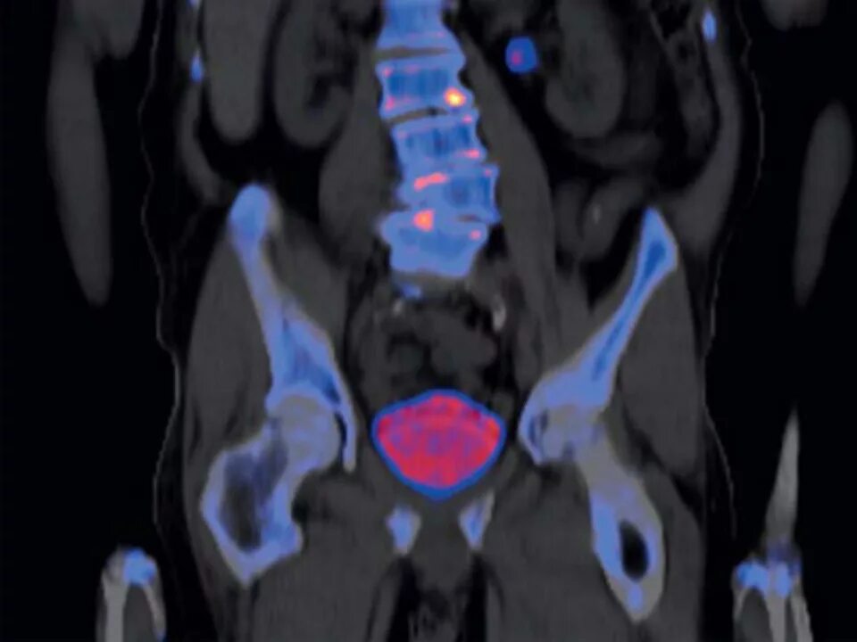 как выглядит рак полового