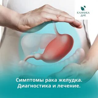 Инфаркт живота