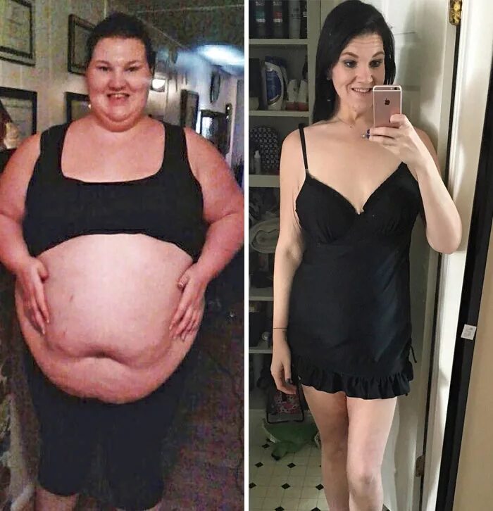 Она сильно похудела. Похудение до и после. Люди до и после похудения. Похудела до и после. Похудевшие до и после фото.
