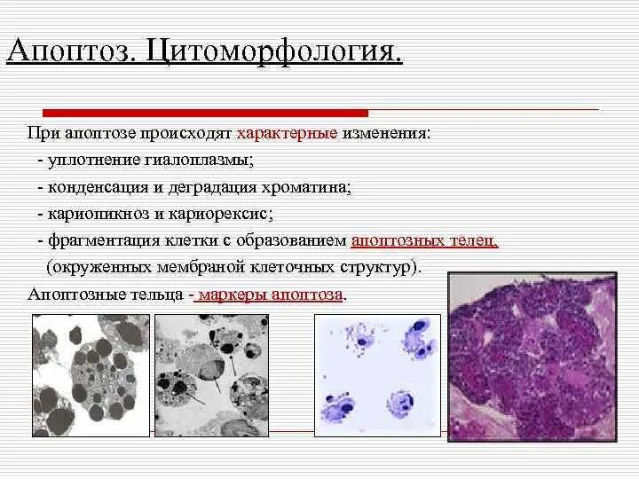 Кариопикноз это. Апоптоз клетки. Морфология апоптоза. Апоптоз обычно захватывает.