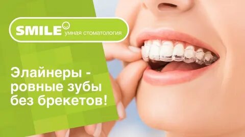 Сколько стоят брекеты в барнауле