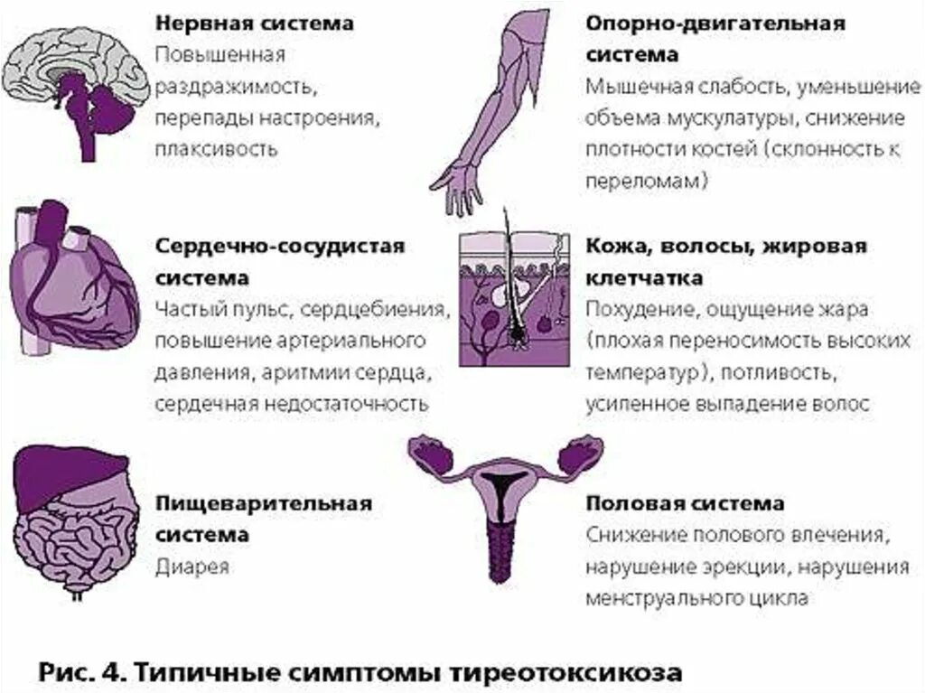 Гипертиреоз симптомы у женщин после 40. Тиреотоксикоз симптомы. Проявления гипертиреоза. Тиреотоксикоз щитовидной железы.