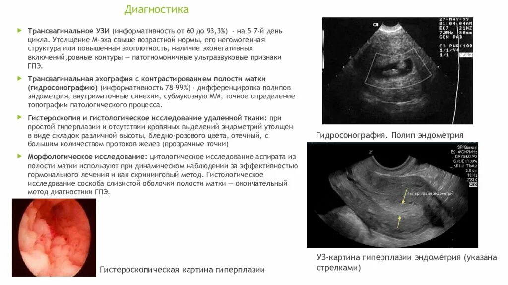 Узи день цикла. Нормы ультразвукового трансвагинального исследования. Полип эндометрия на УЗИ 5 день цикла. Трансвагинальное УЗИ норма.