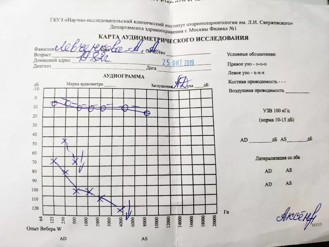 Аудиограмма 4 степени тугоухости. Аудиограмма слуха норма бланк. Аудиограмма заключение. Аудиограмма глухота. Аудиограмма степени