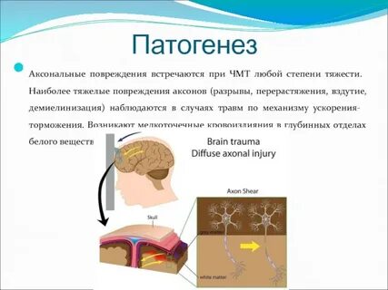 При черепной мозговой травме необходимо