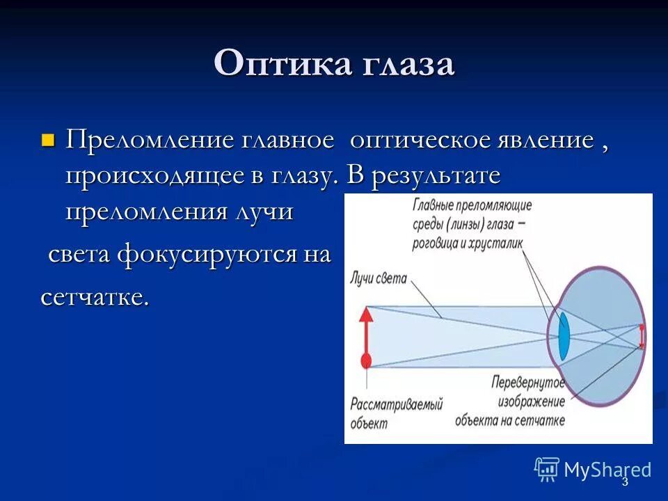 Преломление оптика глаза. Преломление лучей в глазу. Преломление света в оптической системе глаза. Преломление лучей света в оптической системе.