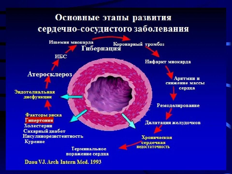 Формы ишемии. Формы ИБС. Клинические формы ИБС. Нозологические формы ИБС:. Ишемия клинические формы.