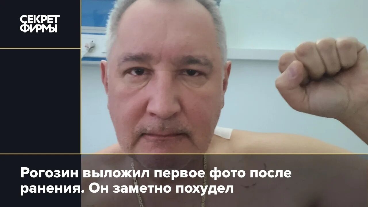 Рогозин последние. Рогозин ранение. Рогозин в обмундировании нато. Рогозин ранение. Рогозин мемы ранение.