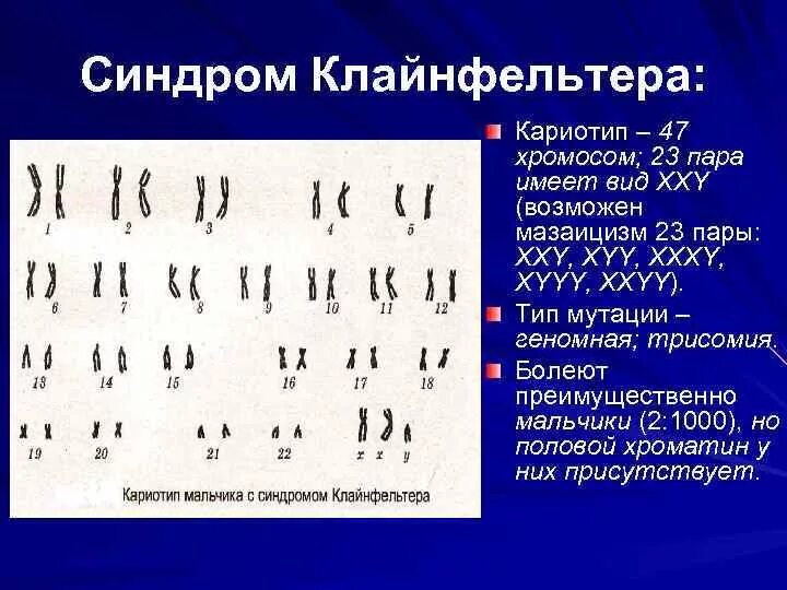 Сколько хромосом в зрелом эритроците. Кариотип синдром Клайнфельтера кариотип. Кариотип больного с синдромом Клайнфельтера. Кариограмма синдрома Эдвардса. Синдром Клайнфельтера хромосомный набор.