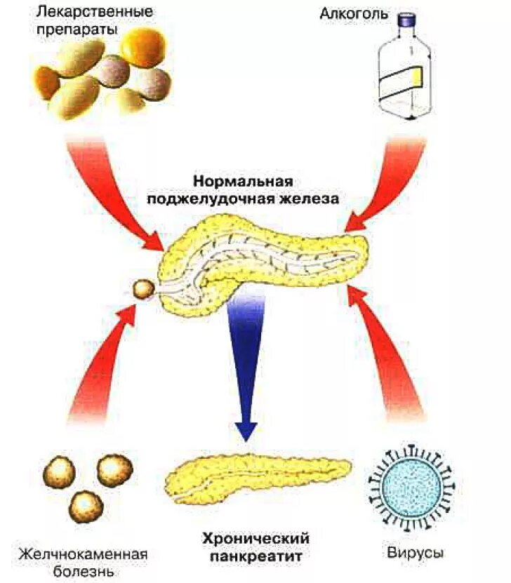 Панкреатит действие