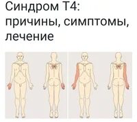Синдром т 4. Синдром т 4