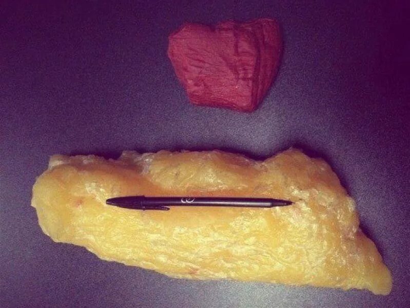 мышечная жировая масса