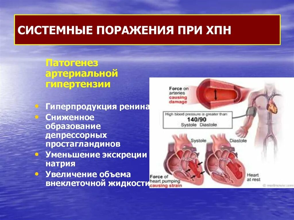 Почечная гипертония