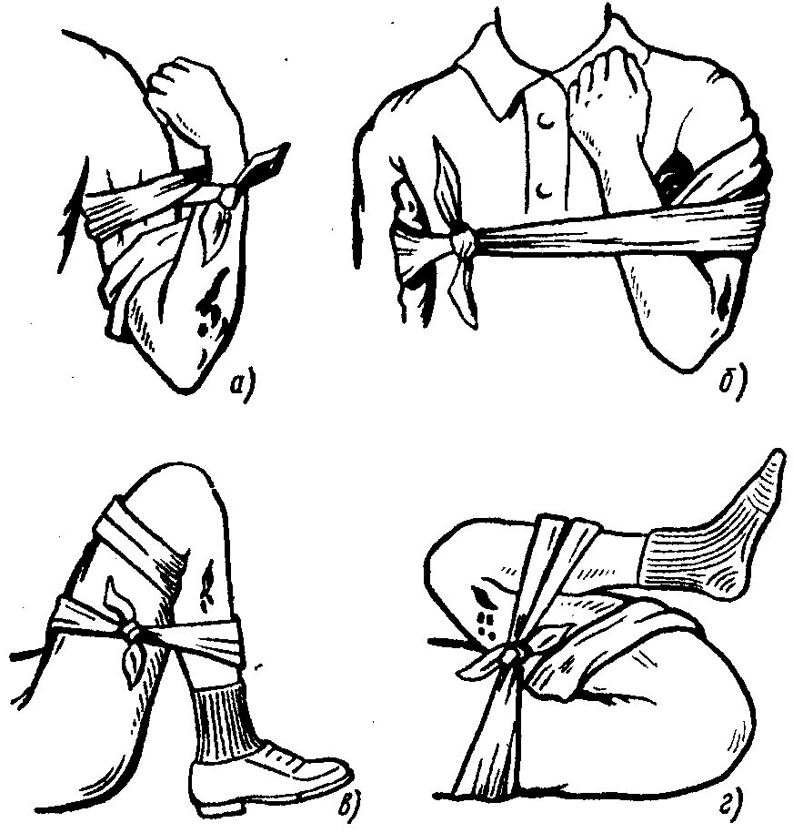 Способы наложения повязок при кровотечении. Остановка кровотечения наложение повязки. Косыночная повязка при кровотечении. Остановка кровотечения косынкой. Турникет перевзяка конечности.