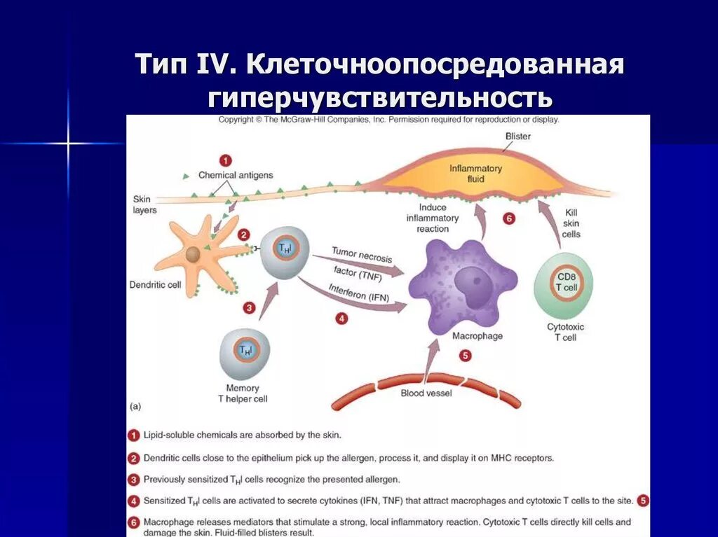 Иммунная гиперчувствительность. IV Тип реакций гиперчувствительности (клеточноопосредованный Тип. Схема гиперчувствительности 4 типа. Гиперчувствительность замедленного типа 4 типа. 4 Тип гиперчувствительности механизм.