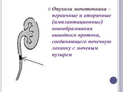 Злокачественное новообразование лоханок почки