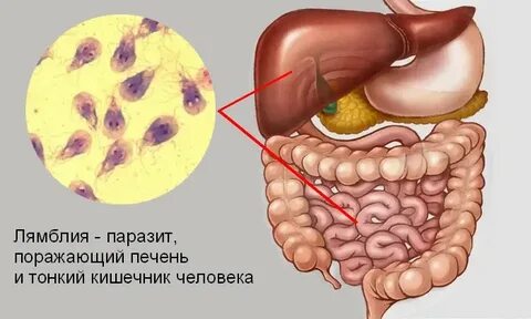 Паразиты человека лямблии